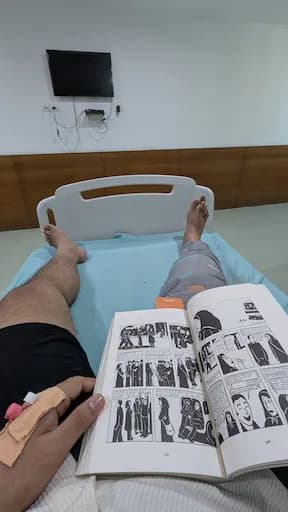 Hardeep's leg post ACL surgery, in recovery